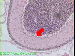 Cerebellum Neonate Purkinje Cell