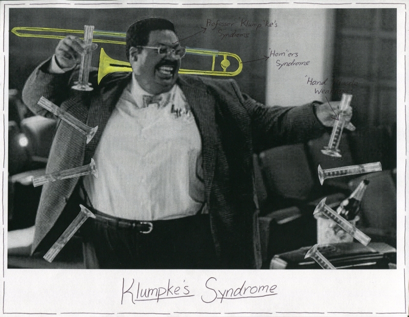 Klumpke Syndrome