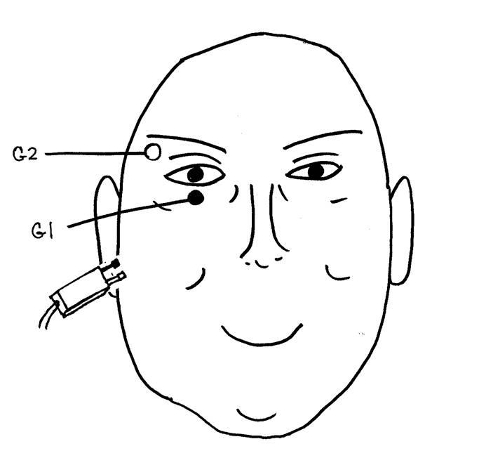 Facial Motor Nerve – recording the Orbicularis Oculi