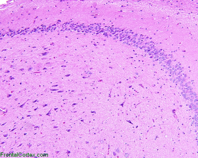 Hippocampal endplate, H&E stained section