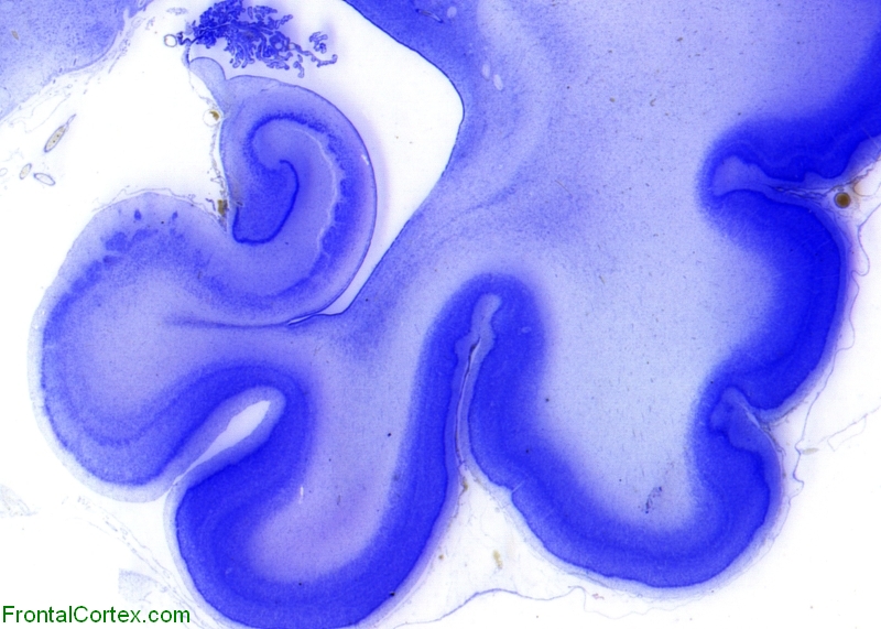 Hippocampus Cresyl Violet Coronal