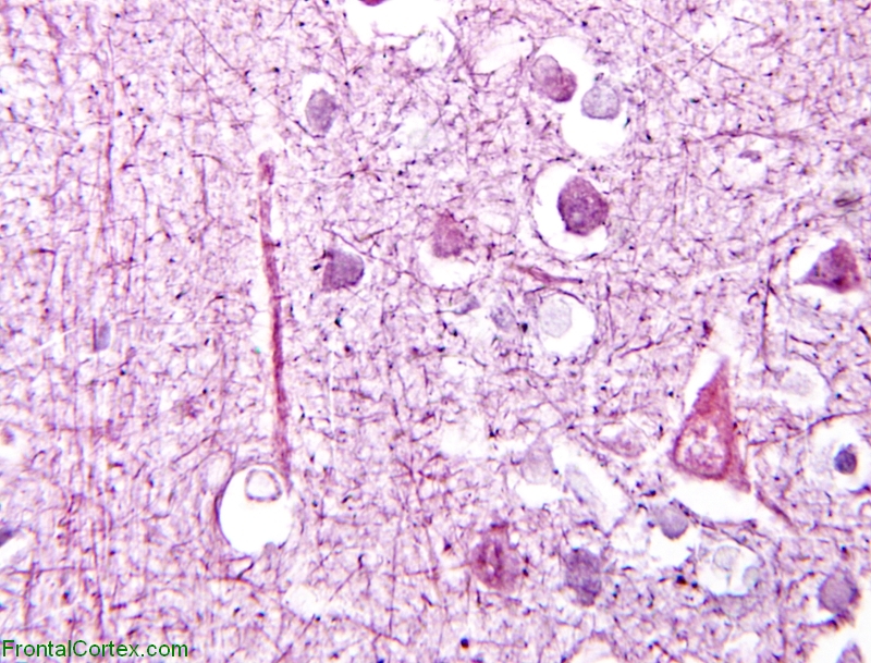 Bodian Stain - Normal Example