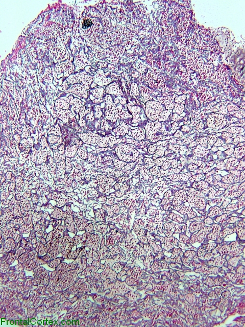 Normal Pituitary Reticulin
