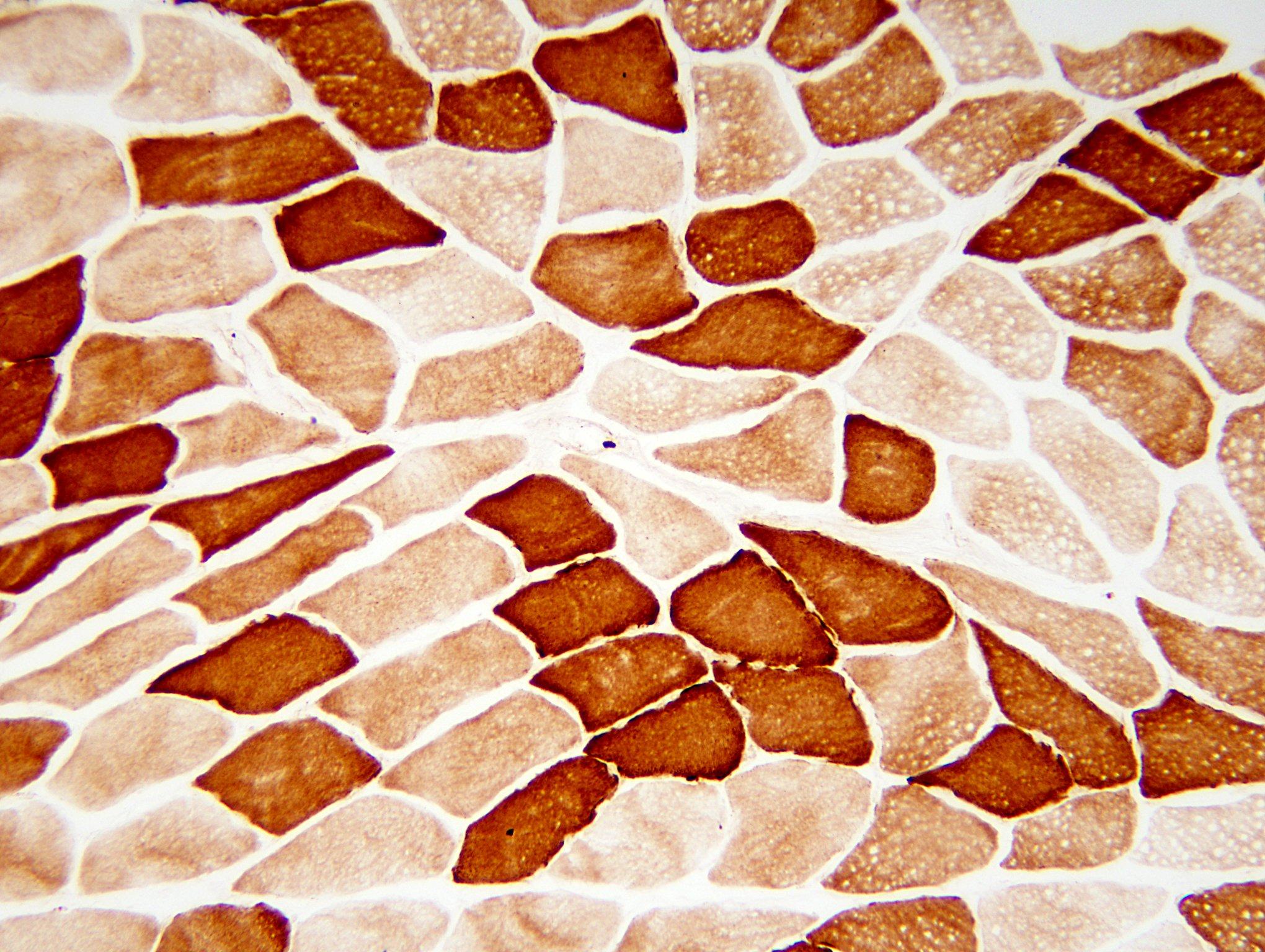 Normal skeletal muscle, cytochrome oxidase stain x 100