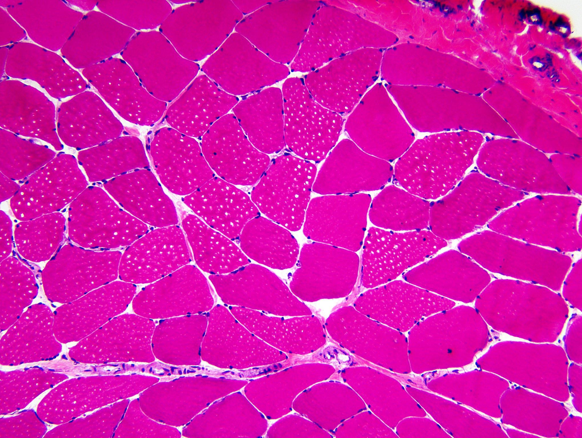 Normal skeletal muscle, H&E stained frozen section x 100