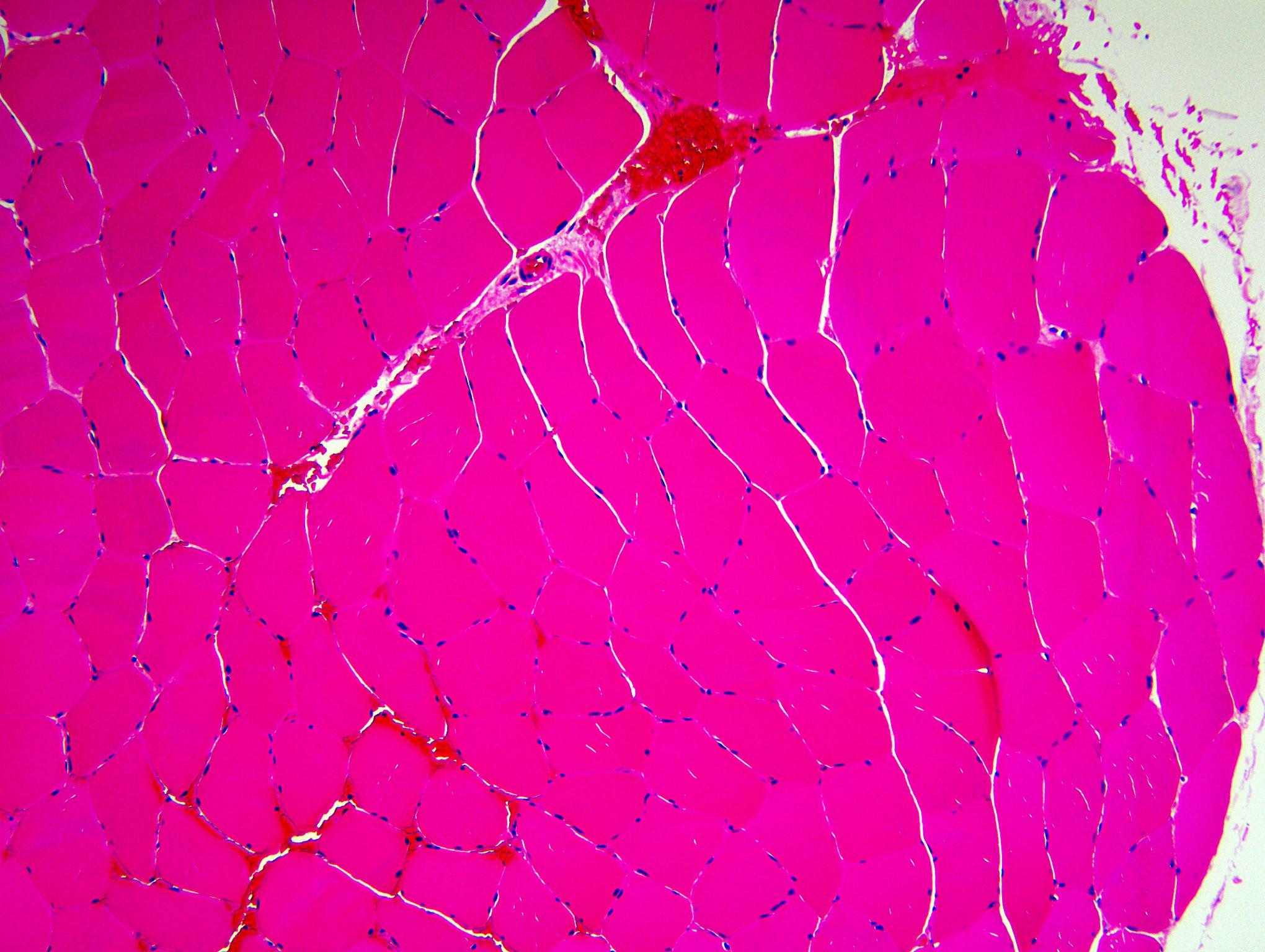  Normal skeletal muscle, H&E stained section of paraffin embedded tissue x 100