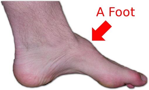 A Foot