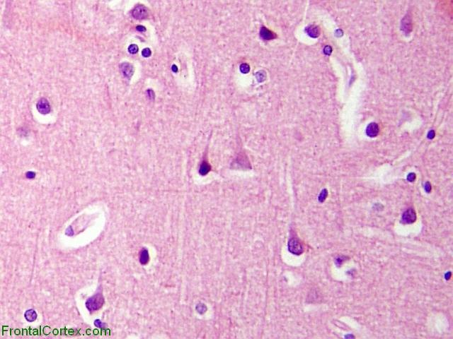 Normal Neuropil - Basic Cell Types