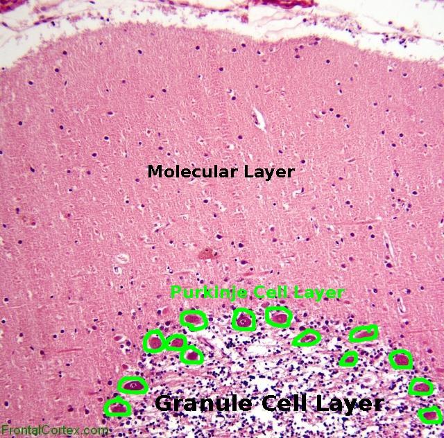 Normal Cerebellum - labelled