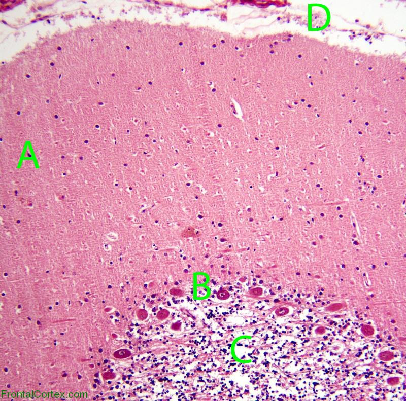 Normal Cerebellum, Labeled with Letters