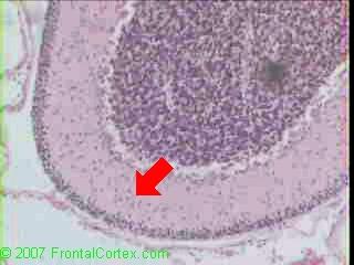 Cerebellum Neonate ML