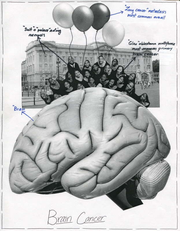 Brain Cancer Incidence In Adults