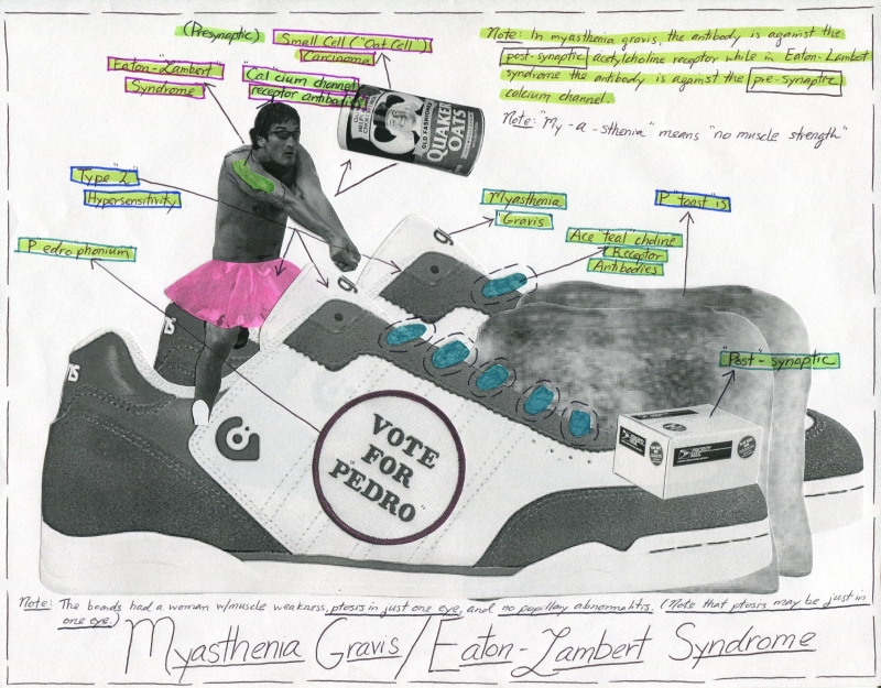 Myasthenia Gravis_Eaton Lambert