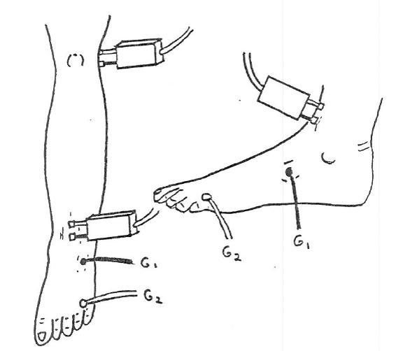 Extensor Digitorum Brevis