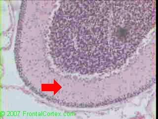 Cerebellum Neonatal ML 2