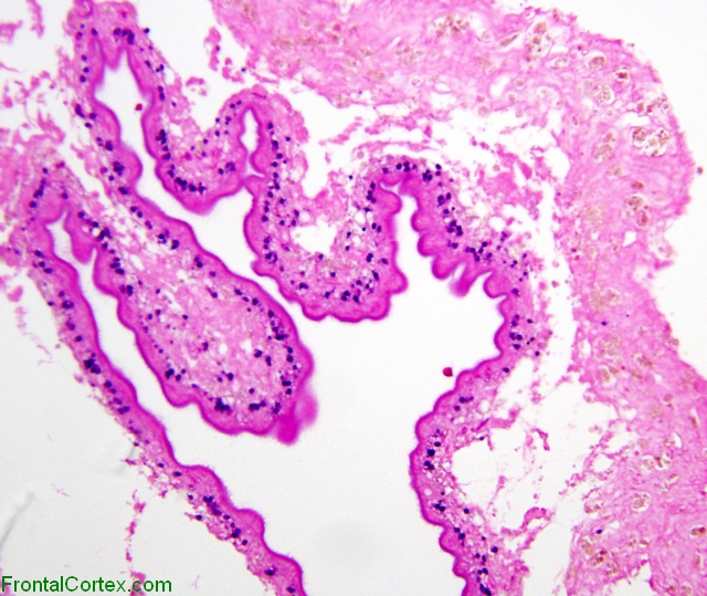 Cysticercus, H&E stained section, high power