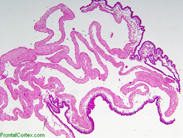 Cysticercus, H&E stain section, low-power