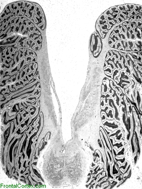 Dandy-Walker Whole Mount Myelin