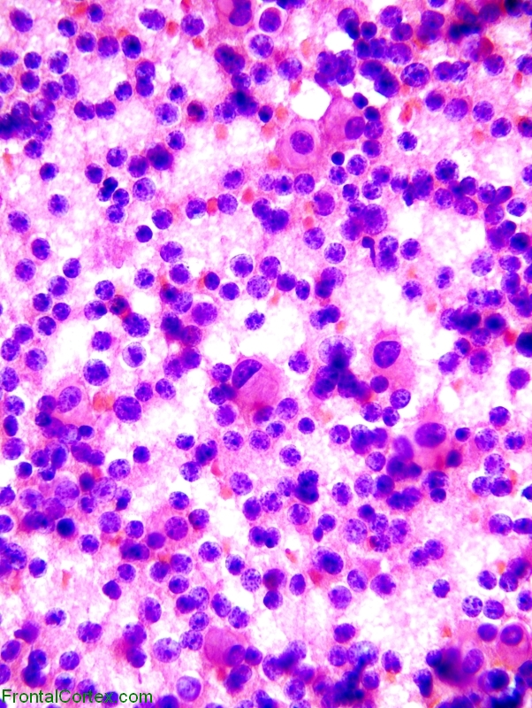 NONADENOMA SMEAR 400x