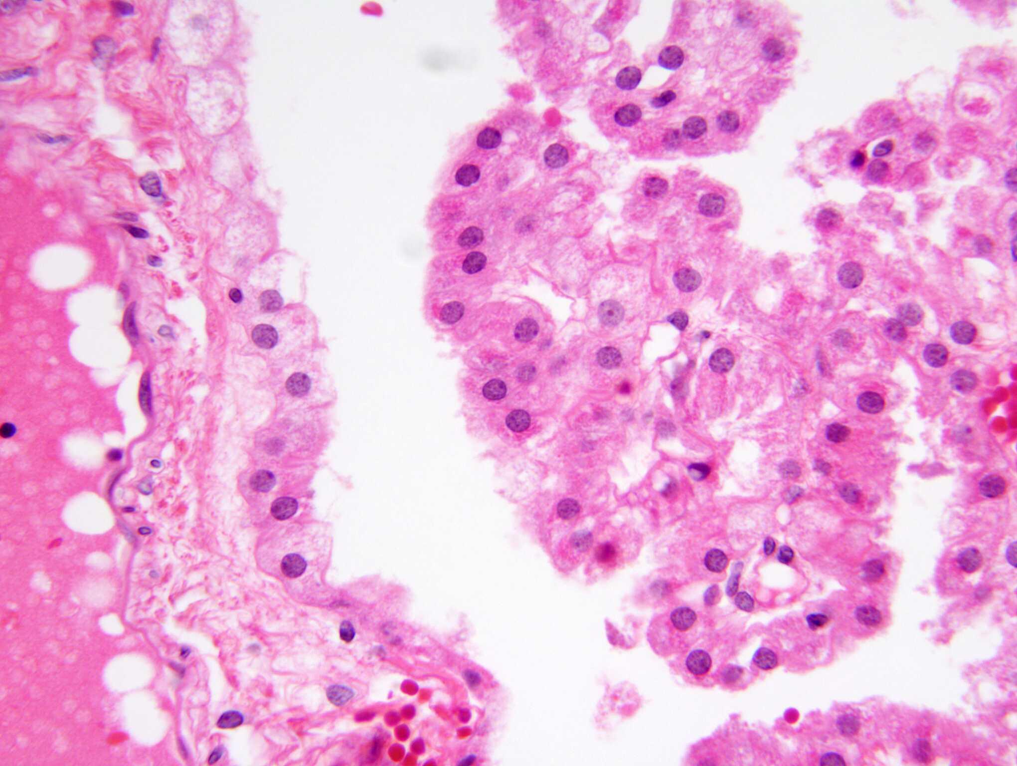 Non-neoplastic choroid plexus, H&E stain x 400