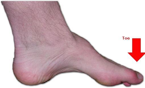 Toe