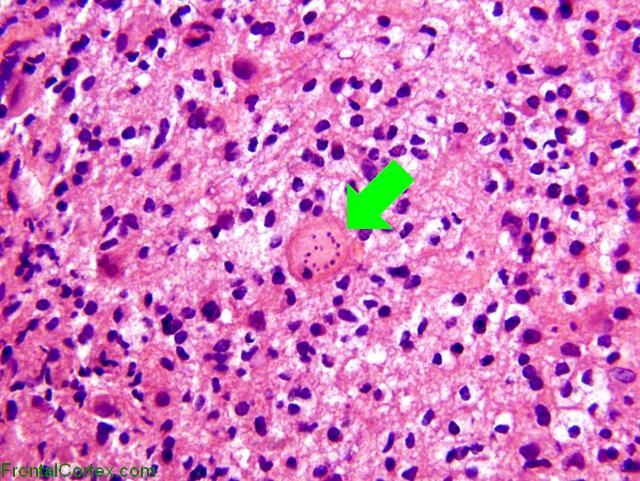 Creutz Cell with arrow