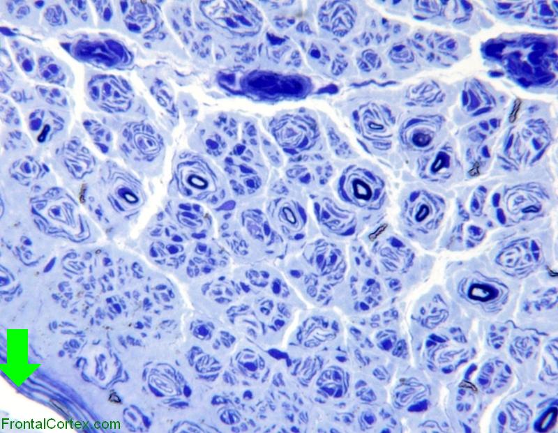 Peripheral Nerve - Perineurium