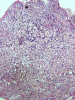 Normal Pituitary Reticulin