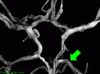 Circle of Willis