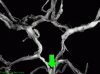 Circle of Willis - Basilar with arrow