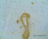 immunohistochemical staining using DAB chromogen.