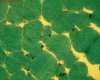 Example of trichrome stain