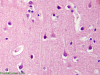 For comparison, normal neuropil