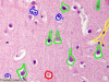 Normal Neuropil with structures highlighted