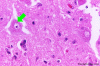 Rabies - Negri Bodies H&E with arrow