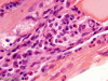 Calpainopathy, paraffin-embedded H&E stained section x 600