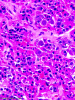 NONADENOMA 400x