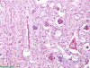 Bodian Stain - Normal Example