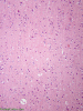 For Comparison, normal neuropil