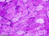 Periodic Acid Schiff (PAS) stain of normal muscle.