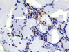 Polymyositis, immunohistochemical staining for CD68 x600