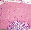 For comparison, normal adult cerebellum