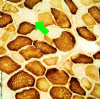 Cytochrome Oxidase staining - Example of pathological findings with arrow