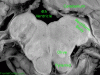 Anatomical Landmarks Labeled