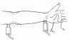 Ulnar Motor Nerve - Recording the Abductor Digiti Minimi (ADM)