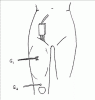 Femoral Motor Nerve - recording the Rectus Femoris.