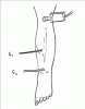 H-Reflex - recording the Soleus