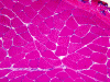 Normal skeletal muscle, H&E stained frozen section x 100