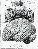 Brain Cancer Incidence In Adults