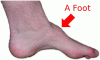 A Foot